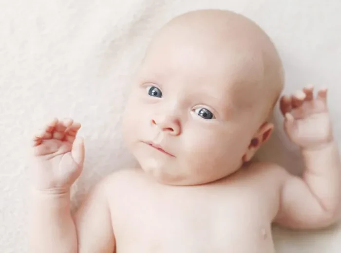 Infant lying on a blanket with head tilted to one side